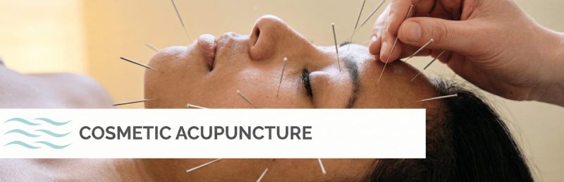 cosmetic-accupuncture (1)